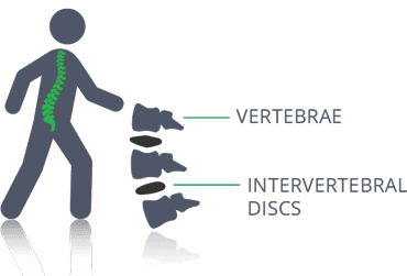 Spine Components - vertebrae and intervertebral discs.